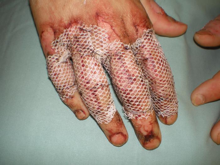 foto k příspěvku  od Collin