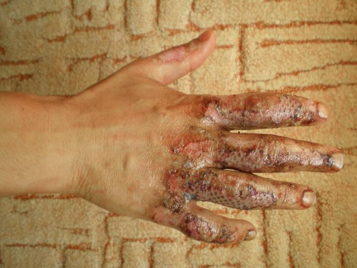 foto k příspěvku  od Collin