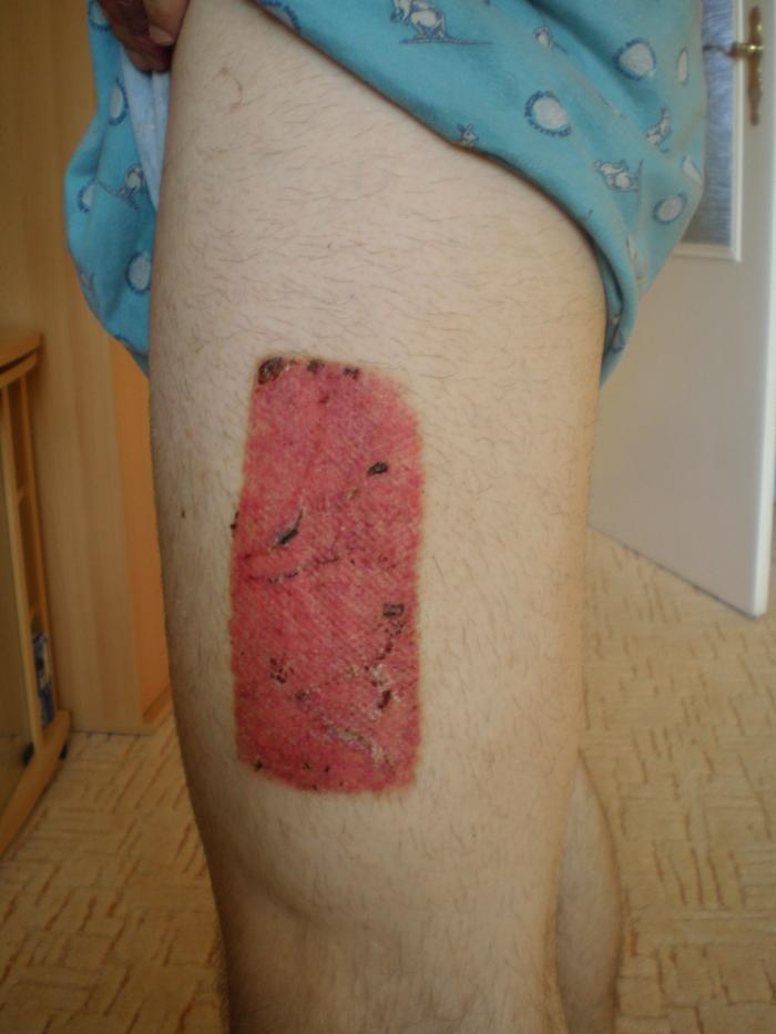 foto k příspěvku  od Collin