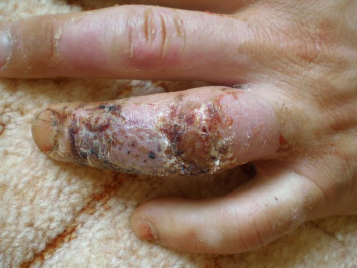 foto k příspěvku  od Collin