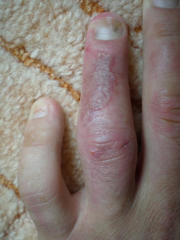 foto k příspěvku  od Collin