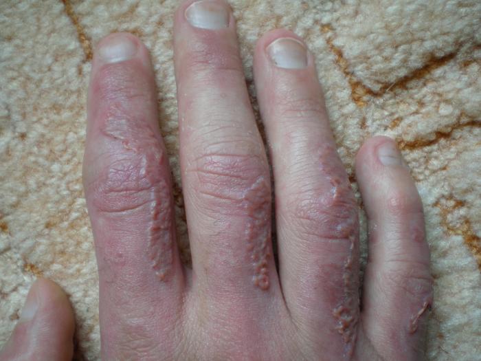 foto k příspěvku  od Collin